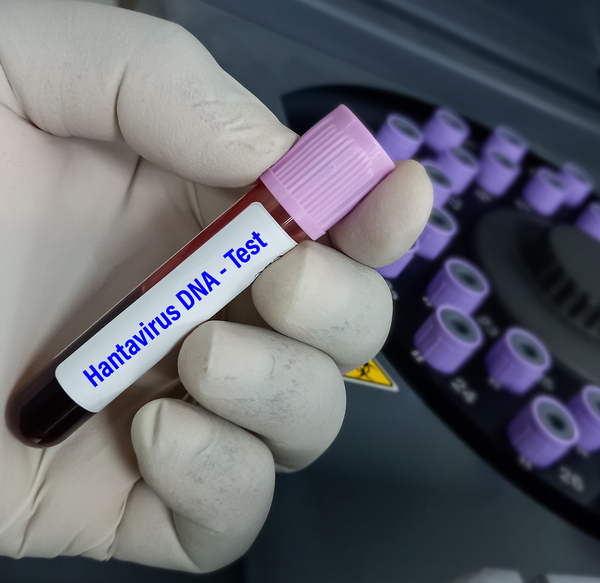 Hantavirus Andes sulla nave Hondius, l’ECDC pubblica le linee guida per passeggeri ed equipaggi