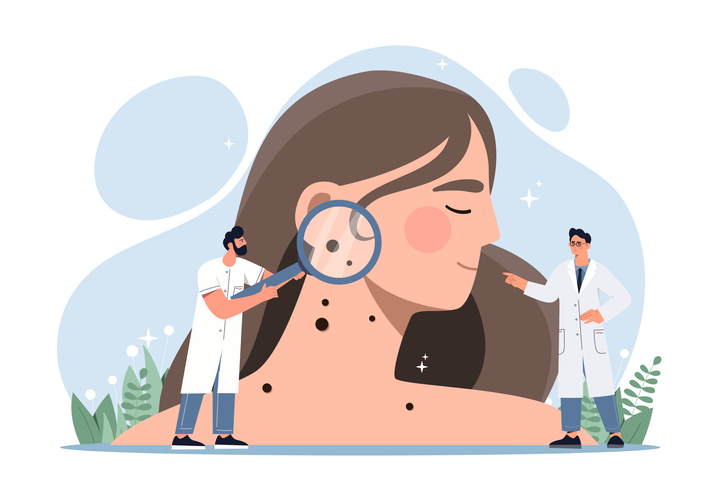 Melanoma, via libera alla Legge n. 99/2026: prevenzione rafforzata e istituita la Giornata nazionale
